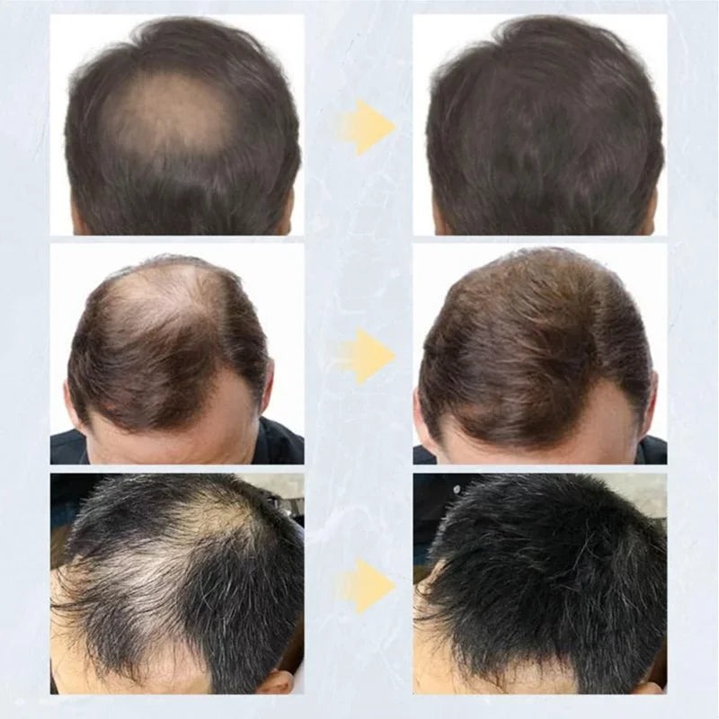 Magic Hair em Pó - Fibra capilar para crescimento, construção e densidade capilar - Instantâneo